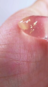 Showing lip balm applied to palm from close up. Reddish tint visible on skin. Lip care product, glossy moisturizing texture for beauty concept.