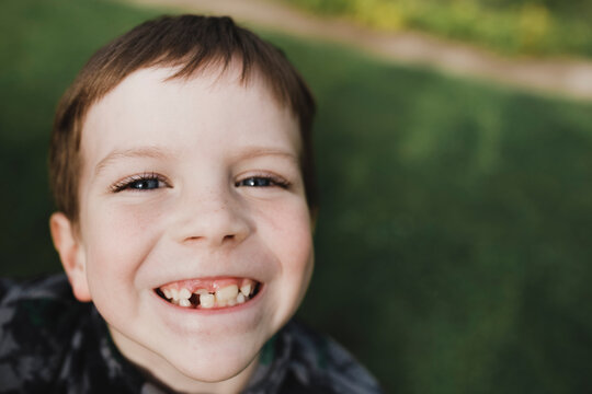 Portrait of a boy with freckles and crooked teeth