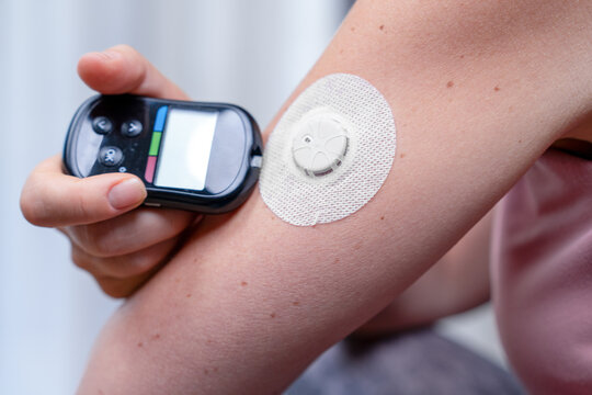 Hand holding a digital glucose meter beside a bare arm wearing a white sensor patch during a home blood sugar monitoring session