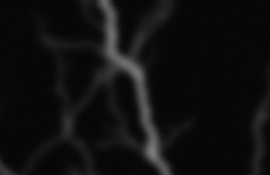 Angiographic imaging of cerebral blood vessels