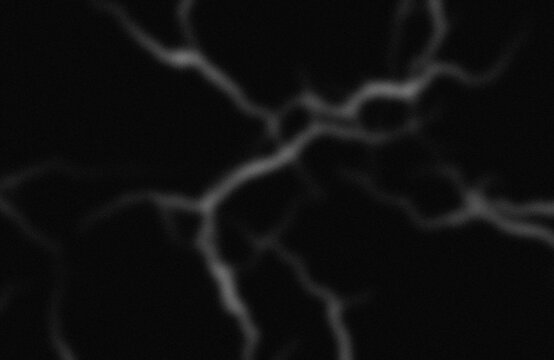 Angiographic imaging of cerebral blood vessels in brain scan