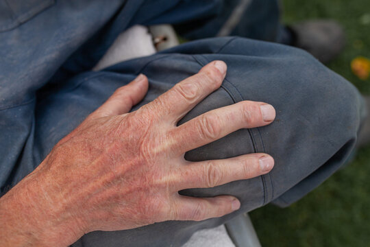 Close-up of elderly man's hand on his knee, showing visible signs of joint deformation, arthritis or rheumatism. Aging, health, and chronic illness.