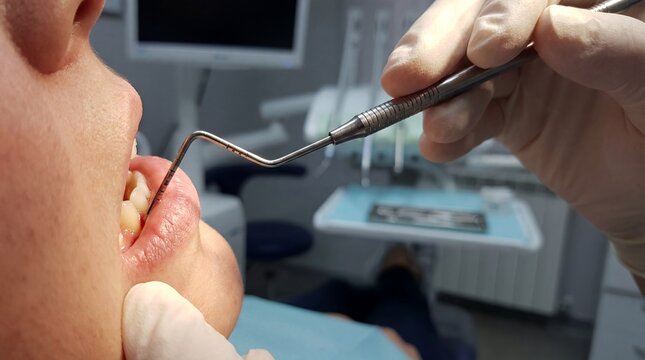 Periodontal probe gum disease pocket depth dentist hands diagnosis showing gingival measurement and preventive oral care concept for periodontics education marketing and early treatment awareness