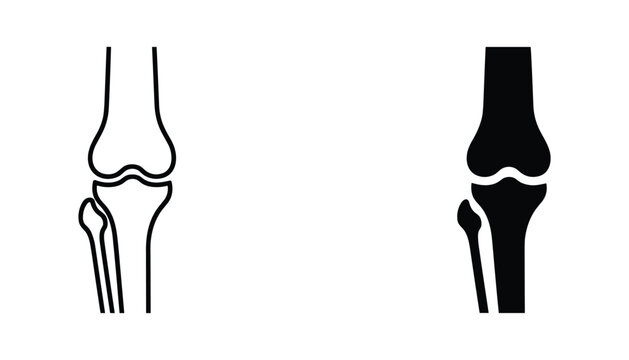 Human knee joint anatomy icon set showing bone structure in outline and solid black styles for medical diagnostics and orthopedic healthcare graphic design and educational materials