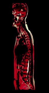 Colorized red and green MRI sagittal scan of the whole human body and spine from head to pelvis on black background vertical animation.