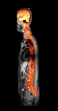 Colorized orange and red MRI sagittal scan of the entire human spine and body from head to pelvis on black background vertical animation.
