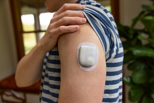 Continuous Glucose Monitor diabetic arm body 