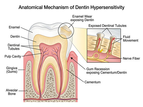 Dentin hypersensitivity anatomical tooth diagram illustration isolated on white background