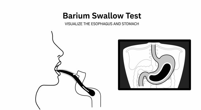 Medical infographic illustrating a Barium Swallow Test procedure, showing a patient drinking contrast medium and a resulting X-ray visualization of the esophagus and stomach on a monitor.