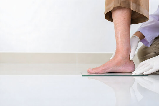 Healthcare Professional Assessing Pes Planus in Older Adult