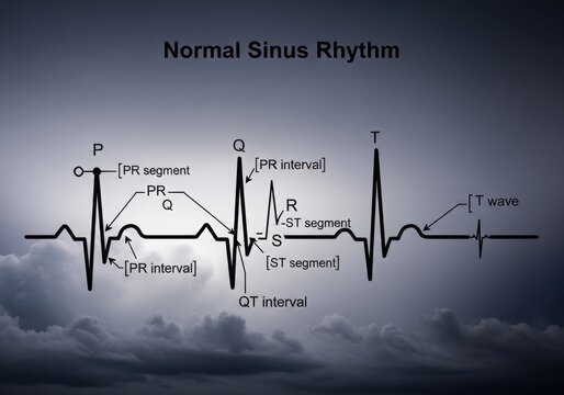 Normal sinus rhythm ecg waveform diagram isolated on white background