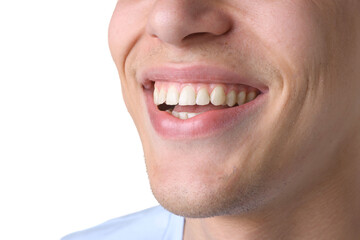 Fototapeta premium Happy young man with healthy teeth on white background, closeup