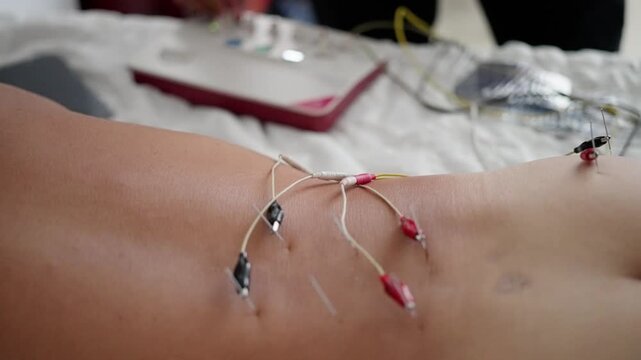electrodes being applied to skin in a clinical setting with precise and close-up perspective focusing on the procedure for a medical procedure in healthcare and medical procedures.