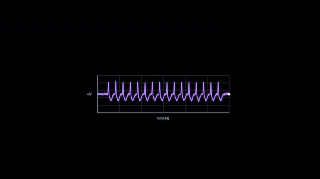 3 Hz Spike and Wave EEG Brain Wave Animation Clean No Text Alpha Channel 4K