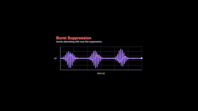 Burst Suppression EEG Brain Wave Animation Labeled Alpha Channel 4K