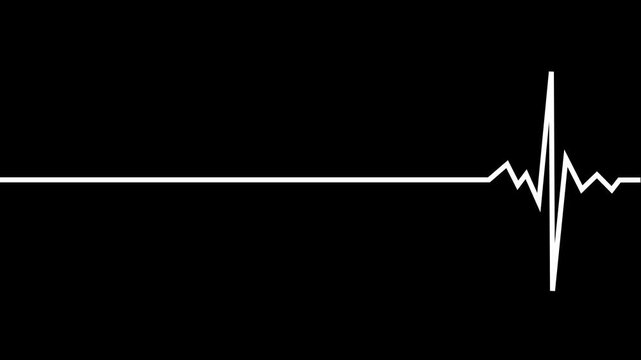 ECG graph, Heartbeat ecg electrocardiogram, pulse rate vector graph wave line. Ekg cardio heart beat cardiology frequency monitor animated on transparent background.