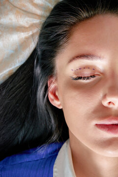  plastic surgeon and young woman with correction lines before cosmetic surgery, drawing lines on eyes