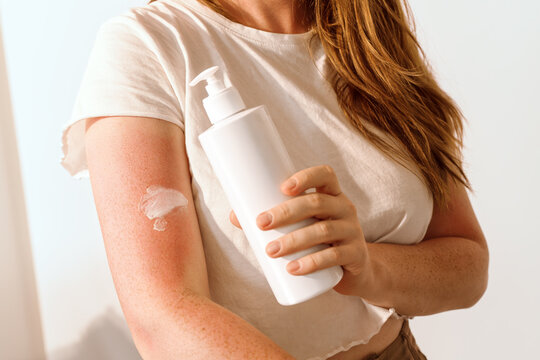 Freckled Woman Holding Sunscreen Bottle With Dispenser for Sunburn Relief