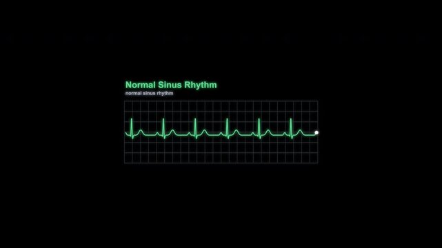 Normal Sinus Rhythm ECG Rhythm Animation Labeled Heart Monitor Alpha 4K