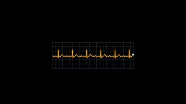 First Degree AV Block ECG Rhythm Animation Clean No Text Heart Monitor Alpha 4K