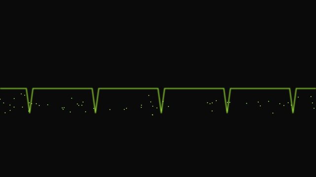 Green heartbeat ekg line monitor pulse animation on 4k black background
