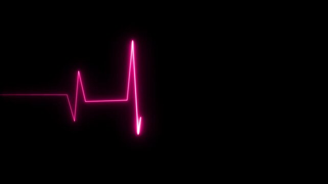 heart beat on monitor