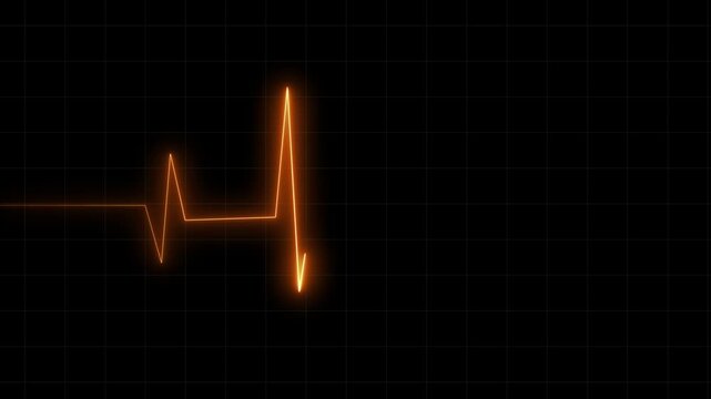 heart beat cardiogram