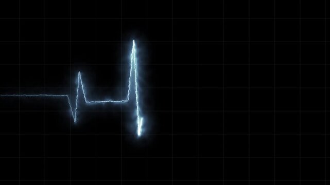 heart beat cardiogram