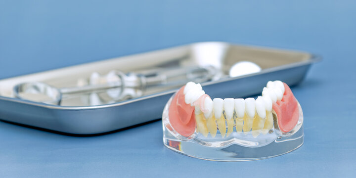 Prosthodontics concept. Clear anatomical teeth model with bilateral flexible partial dentures. Wide web banner with blurred stomatology tools and empty space.