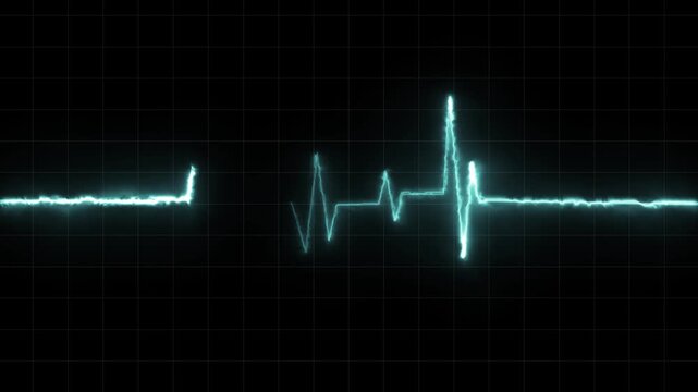 Heartbeat Monitor Animated Video, Heartbeat Medical Cardiogram Animation