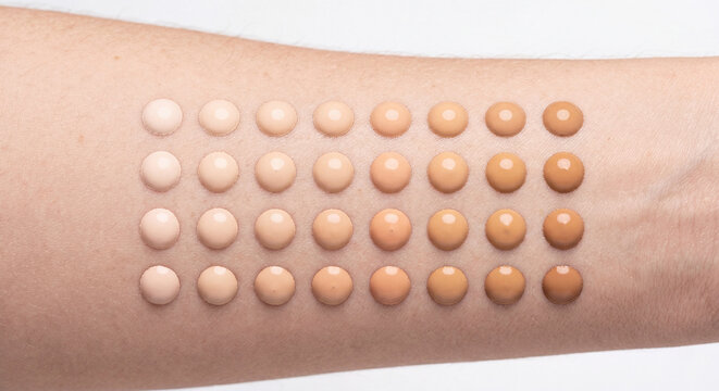 Close up of rows of small cosmetic cream dots or skin allergy patch test samples applied onto a human arm skin surface. Dermatology and product trial concept.