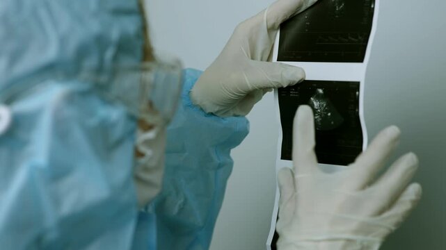 Doctor Pointing At Ultrasound Scan Image Printout. Diagnostics Sonogram Result In Hospital 