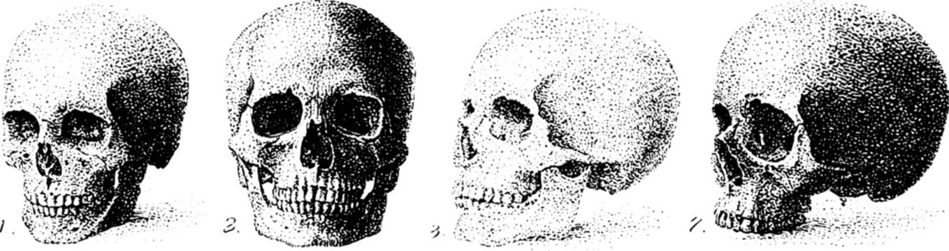 Antique anatomical human skull sequence showing four angles side and three quarter views for medical reference chart and educational background