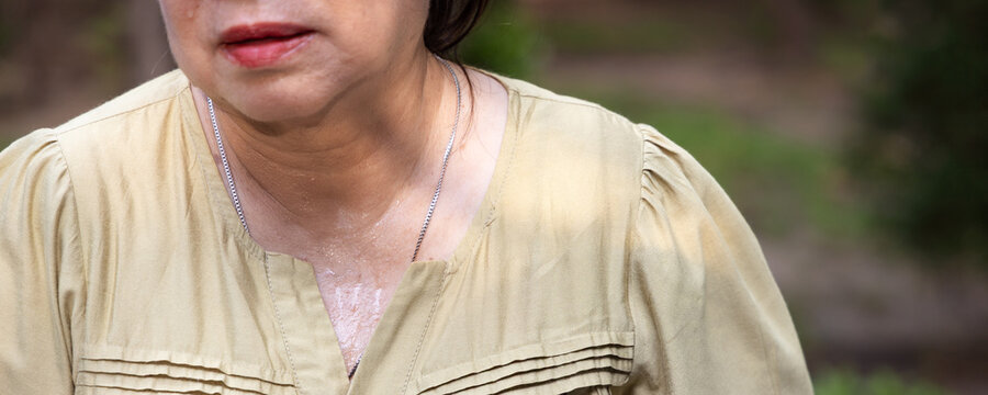 senior asian woman sweating heavily from hot summer weather in a park during daytime, elderly heat exhaustion sweating neck closeup shot, header crop