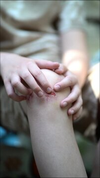Close-up of sore and scraped wound on child's knee. Fingers press and examine the red spot, highlighting the minor lesion and raw skin details.
