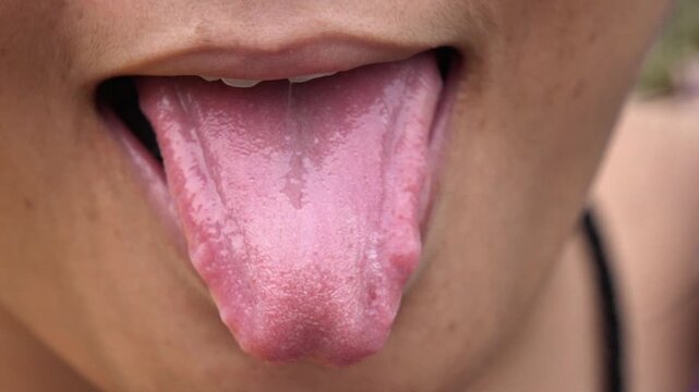 Extreme Close Up Macro Shot of Woman Sticking Out Her Tongue. Medical Anatomy Concept Showing Human Tongue Texture and Taste Buds. Female Open Mouth Showing Pink Tongue Surface.