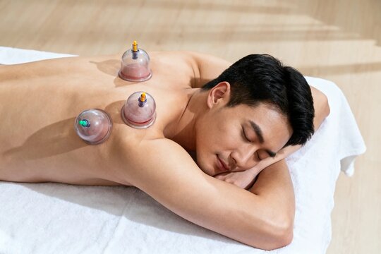 Man Receiving Cupping Therapy Massage on Back