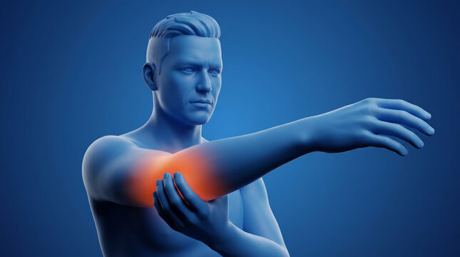 Medical illustration of a man with elbow joint pain