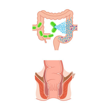 Medical Illustration of Human Colon and Rectum Anatomy Featuring Probiotic Action and Digestive Health Concepts