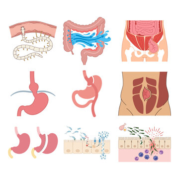 Medical Illustrations of Human Digestive System Disorders and Gastrointestinal Pathologies Set