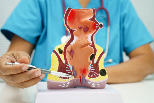 Uterus, doctor holding human anatomy model for study diagnosis and treatment in hospital.