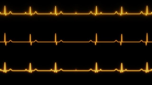 Heart monitor sinus rhythm pattern on black background for medical, healthcare, digital health, cardiology, and technology design concepts.