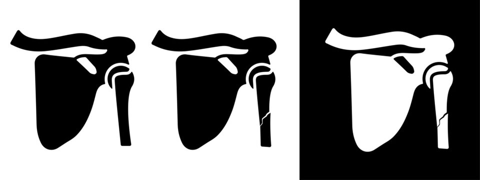 Shoulder broken bone icon silhouette, Clipart vector illustration. PNG. Editable stroke. Broken Arm and Shoulder Joint.