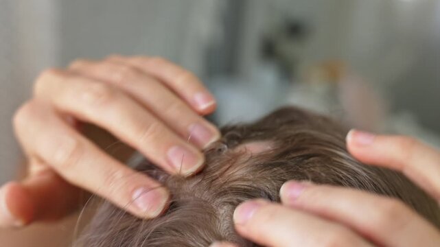 An intimate glimpse of a woman with alopecia tenderly inspecting her scalp. Her hands gently part her hair, observing the areas of thinning, a quiet moment of self-care indoors.