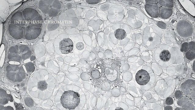 Interphase chromatin structures in a microscopic view of cell nuclei and organelles in a biological sample