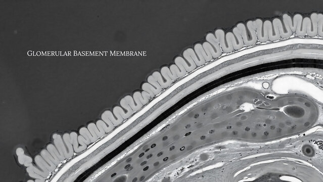 Glomerular basement membrane structure in human kidney under microscope  Glomerular basement membrane