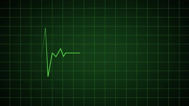 4K video digital heartbeat flatline ECG monitor animation on transparent background.