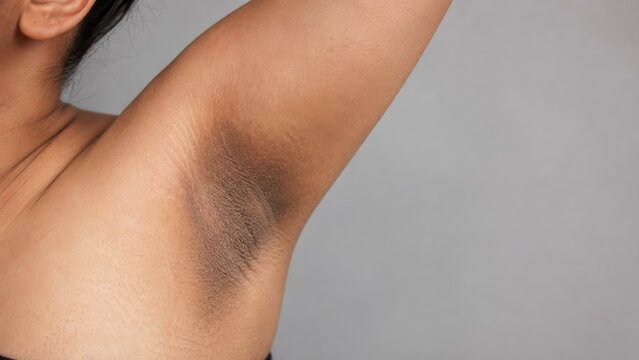 Close-up of underarm skin with natural dark pigmentation on light brown skin tone