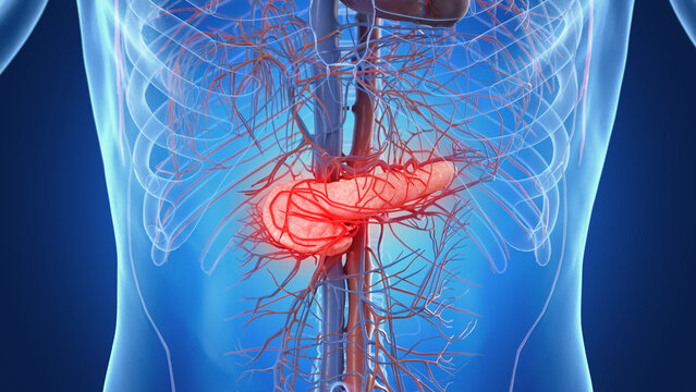 Illustration of a male inflamed pancreas
