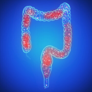 Illustration of the microbiota of an inflamed colon